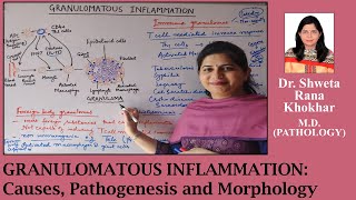 Granulomatous Inflammation Causes Pathogenesis and Morphology  Immune and Foreign body granulomas [upl. by Daenis]