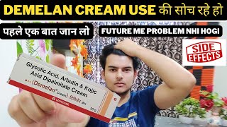 demelan cream review  demelan cream best pigmentation cream  how to remove pigmentation amp darkspot [upl. by Lundeen987]