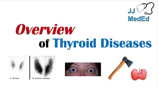 Overview of Thyroid Diseases Hashimoto’s Graves’ Sick Euthyroid Syndrome Toxic adenoma etc [upl. by Ameline]