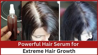 Powerful Hair Serum for Extreme Hair Growth  Fast Hair Growth  SADIKA TASMIM [upl. by Nnoj]