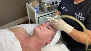 Microdermabrasion Facial Demonstration [upl. by Acinelav]