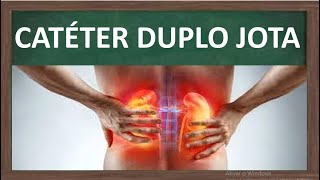 Cateter Duplo J para que serve  enfermagem [upl. by Icyac]