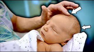 THIS NEWBORN HAS 2 HOLES IN HIS SKULL Fontanelle  Dr Paul [upl. by Hanimay142]