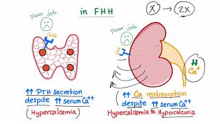 Familial Hypocalcuric Hypercalcemia FHH  Endocrinology and Nephrology [upl. by Gagliano]