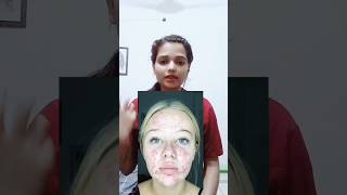 ACNE SKINCARE ROUTINE😱follow for more skincare darkspots annetreatment acne beauty [upl. by Elorac802]