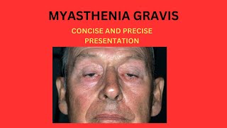 MYASTHENIA GRAVIS [upl. by Bacchus902]