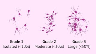 Mixed Agglutination Reaction MAR Test  semenhealth semen analysis fertility fertilitytest [upl. by Bettzel331]