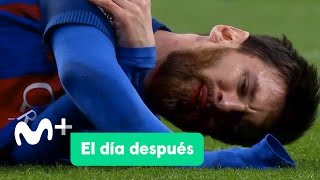 El Día Después 24042017 El Clásico de Messi [upl. by Irt]