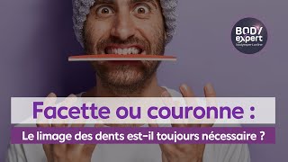 SOINS DENTAIRES  🦷 Facettecouronne  Le limage des dents estil toujours nécessaire   BODYEXPERT [upl. by Kolb]