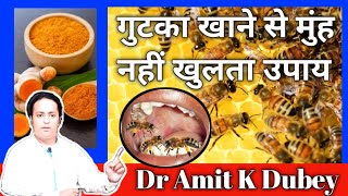 Osmf treatment in hindi  muh ke kam khulne ka upay  dramitkdubey [upl. by Atiluap]