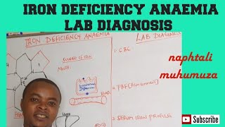 Iron Deficiency Anaemia  Causes amp Signs  Lab diagnosis  Hematology [upl. by At]