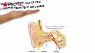 Behandlung des Ohrendruck [upl. by Vaenfila54]