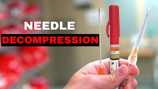 How To Chest Needle Decompression [upl. by Bennink126]