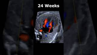 737 Weeks EmbryonicFetal Heartbeat Ultrasound Appearances  Baby Heart Motion USG babyheartbeat [upl. by Laurella819]