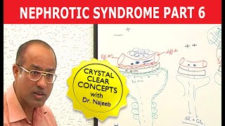 Nephrotic Syndrome  Part 6🩺 [upl. by Ttenaj43]