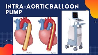 IntraAortic Balloon Pump IABP  Counterpulsation [upl. by Seaden]