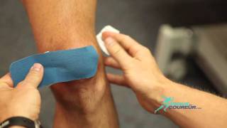 Taping genou  Syndrome fémoropatellaire [upl. by Wendi]