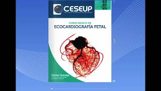 Manual de ecocardiografía fetal Pronto a la venta [upl. by Corabella]