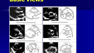 Echogenic focus in the left ventricle  Tamil  how to cure echogenic focus in tamil [upl. by Carilyn]