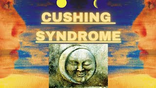 Cushing syndrome  Easiest diagnostic algorithm and Dexamethasone suppression test [upl. by Akcinahs]