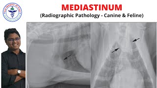 Mediastinum  Radiology  Lecture 13 [upl. by Schriever]