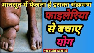 फाइलेरिया हाथी पाव से बचाव How To Cure Filaria [upl. by Burt]