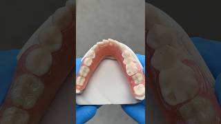 Lower TCS Unbreakable FiberFlex Partial EnvisiontecMain tcsdentalinc envisiontectcsdentalinc [upl. by Fuller168]