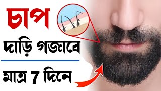 দিনে 2 বার লাগিয়ে নিন ঘন চাপ দাড়ি 7 দিনে গজাবে  HOW TO GROW BEARD FASTER BANGLA [upl. by Oiliduab]