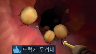 대장내시경하는 의사가 되어보는 공포게임 [upl. by Adehsar]