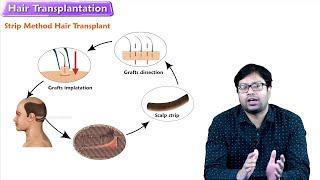 Hair Transplant Growth Journey  Adrian Brown from Australia [upl. by Niroc]