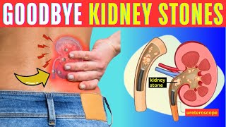 Natural Kidney Stone Remedies Effective Ways to Get Rid of Stones Naturally [upl. by Enylecoj]