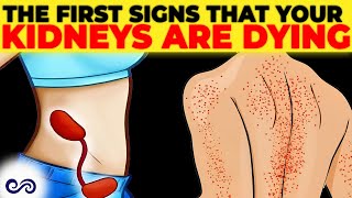 5 Early Signs Your KIDNEYS Are Dying itchy skin [upl. by Colly]