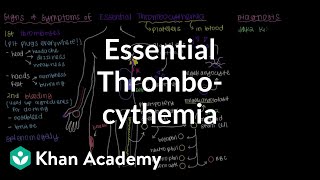 What is essential thrombocythemia  Hematologic System Diseases  NCLEXRN  Khan Academy [upl. by Krenek]