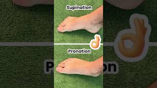 Fix Your Bunions amp Overpronation at The Same Time [upl. by Bannasch]