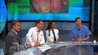 The Doctors on Laser Toenail Fungus Removal [upl. by Sileas]