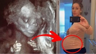 Woman’s Baby Bump Keeps Growing Then Doctor Spots Something Unusual In Ultrasound [upl. by Neellek896]