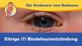 Eitrige  Bindehautentzündung — Der Kinderarzt vom Bodensee [upl. by Ciredec]