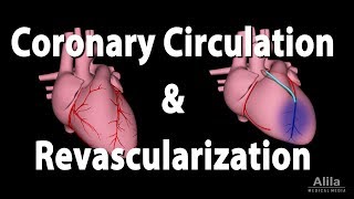 Coronary Circulation and Revascularization Animation [upl. by Tucky]