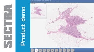 Sectra Digital Pathology PACS [upl. by Cristian]