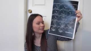 14 Weeks Pregnant  Morning sickness food aversions [upl. by Eillen564]