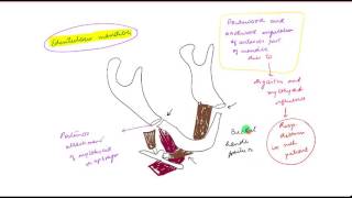 Mandibular fracture PART 1 [upl. by Ivie]