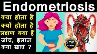 What is Endometriosis in Hindi Symptoms Treatment Diet Surgery Occurs Affects fertility [upl. by Gus]