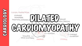 Dilated Cardiomyopathy  causes symptoms pathophysiology and treatment [upl. by Ramaj320]