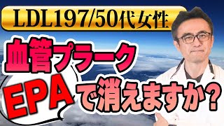 【LDLコレステロール】EPAで頸動脈プラークは消えますか？ [upl. by Swerdna872]