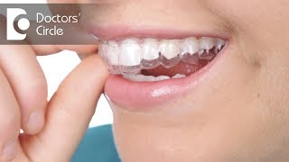 What are aligners for teeth  Dr Aniruddha KB [upl. by Vanna957]