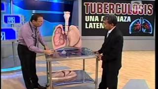 La tuberculosis  cómo se desarrolla tipos y tratamiento [upl. by Varden]