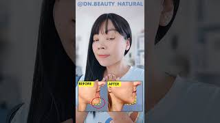 CHIN CORRECTION EXERCISE  Fix Protruding Chin Improve Chin Ptosis Witchs Chin [upl. by Bull89]