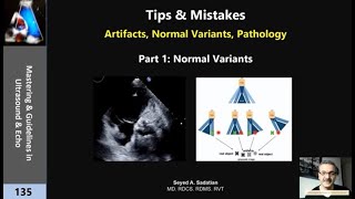 Tips amp Mistakes Artifacts Normal Variants Pathology part 1 [upl. by Senoj974]