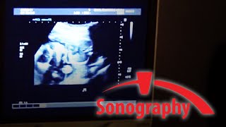 SONO – Sonography  BRCC [upl. by Cutcheon]