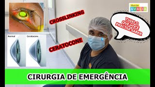 Cirurgia Crosslinking para ceratocone CEMA  Tudo o que você precisa saber [upl. by Onfroi]